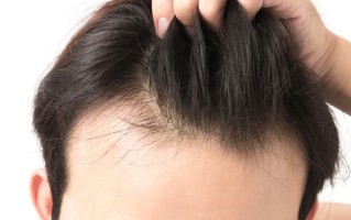 促进头发生长的方法（促进头发快速生长的技巧） !