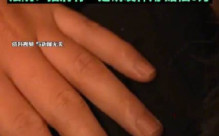 老人被拍肩膀吓到脑出血起诉索赔！法院:拍肩有一定诱发作用 赔偿8万 ！