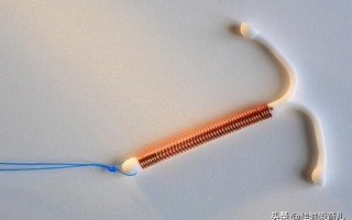 上环好还是结扎好（女人生育孩子后上环和结扎怎么选择） ！