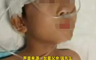 安徽7岁女童被恶犬撕咬致毁容！家长：已经花费四五万元，准备卖车救女儿 ！