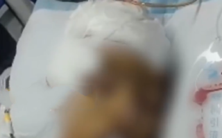 中学生疑被3名学生打成植物人 ！警方回应：此事已列为刑事案件，移交至刑侦大队 ！