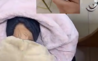 女生被老鼠咬伤手下秒反咬老鼠 ！网友：真以牙还牙 ！