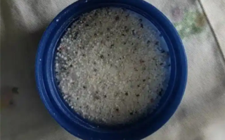 男孩把疏通剂当玩具 双手被灼伤差点不保 !