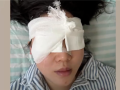 “右眼瞬间失明”！女游客高压水枪伤眼 如何应急处理 ！