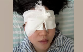 “右眼瞬间失明”！女游客高压水枪伤眼 如何应急处理 ！