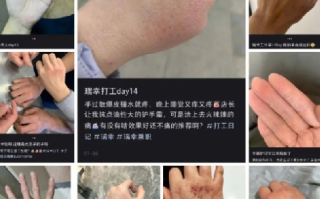 瑞幸被曝洗手流程致员工烂手：系频繁洗手以及徒手接触消毒水等缘故 ！