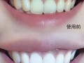 怎么让黄牙变白（除了洗牙还有哪些方法能让牙齿变白） ！