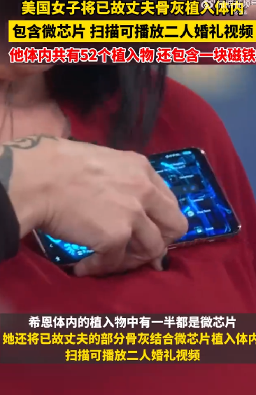 美一女子将丈夫骨灰结合微芯片植入体内：扫描后可以播放二人的婚礼视频 ！-第1张图片