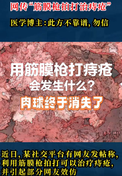 筋膜枪可以治痔疮?医生回应：会造成血管破裂，肛门损伤，勿信 ！-第1张图片