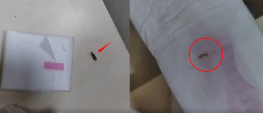 女生称未开封卫生巾内有活虫 ！客服回应：可能是仓储运输等环节导致 ！-第1张图片