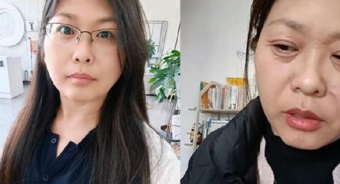42岁女子20天断崖式衰老！直言：20天前还好好地，只能告诉自己放轻松 ！-第1张图片