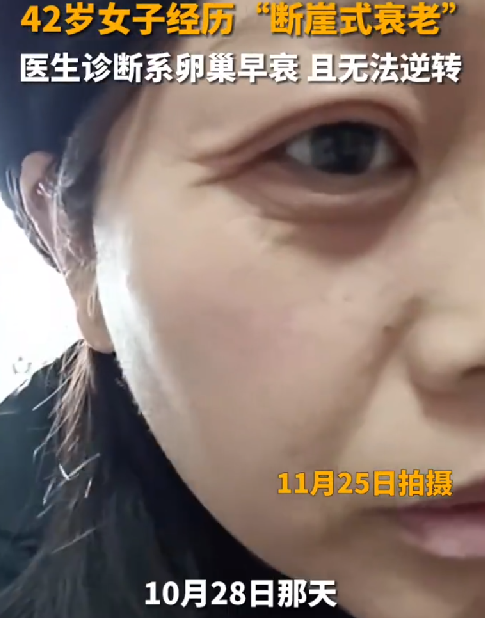 42岁断崖式衰老女子确诊卵巢早衰：且无法逆转 ！-第1张图片