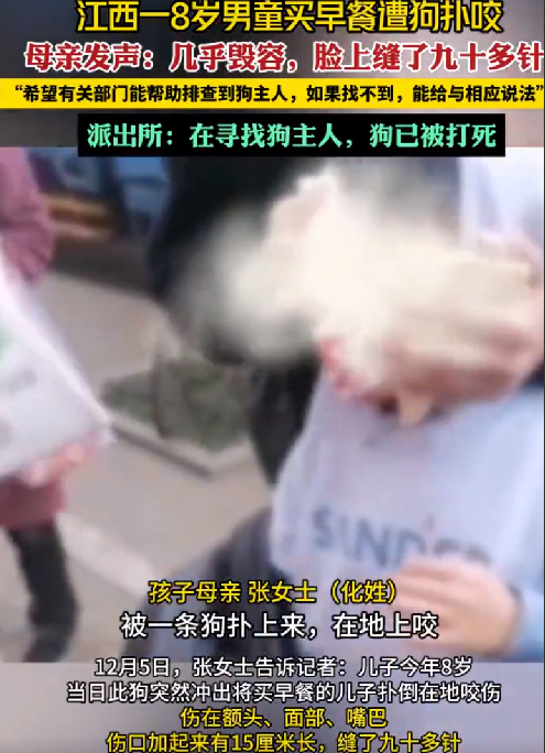 8岁男童遭狗扑咬 脸上缝了90多针：面部几乎毁容，狗已被打死，警方正在寻主人 ！-第1张图片