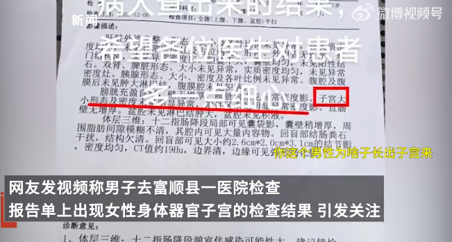 男子CT报告现子宫?院方回应：远程会诊时性别信息登记错误，已重新出报告 ！-第1张图片
