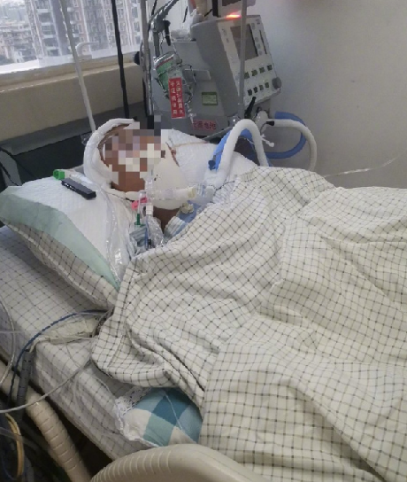 中学生被打进ICU 专家称抢救难度大：希望只有万分之一 ！-第1张图片
