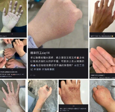 瑞幸被曝洗手流程致员工烂手：系频繁洗手以及徒手接触消毒水等缘故 ！-第1张图片