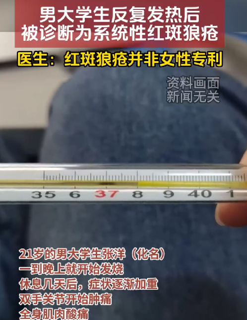 21岁男子发烧后被诊断为红斑狼疮 ！医生:红斑狼疮并非女性专利 ！-第1张图片