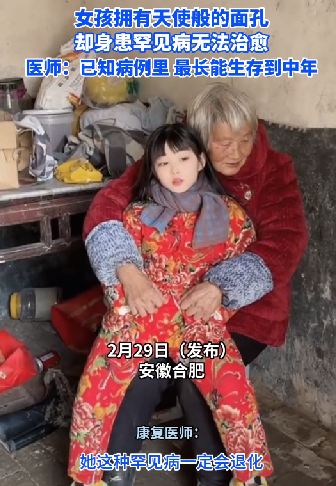 女孩拥有天使般面孔却身患不治之症 网友：落入凡间的天使 ！-第1张图片